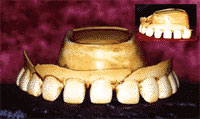 Dentadura feita de uma bola de Bilhar